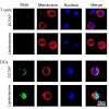 endres_anz_2010_jimmunol_500.100x0.jpg