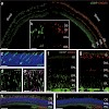 michakalis_muehlfriedel_mol_therapy_2010_500.100x0.jpg